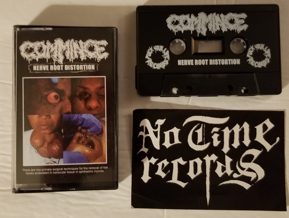 Commince - Nerve Root Distortion Cassette